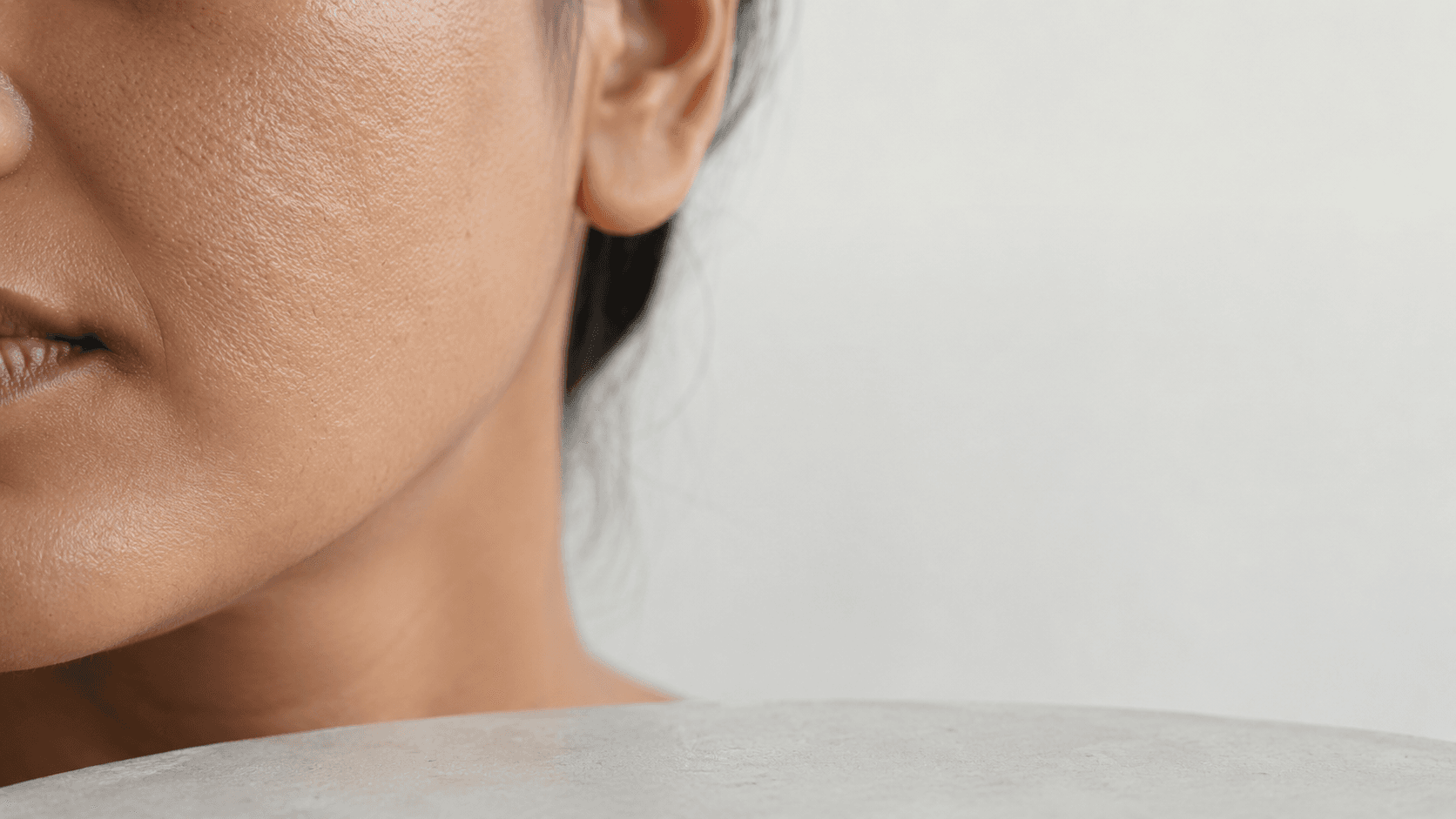Close-up of Indian skin showing dehydration texture — natural moisturizing factor science explained